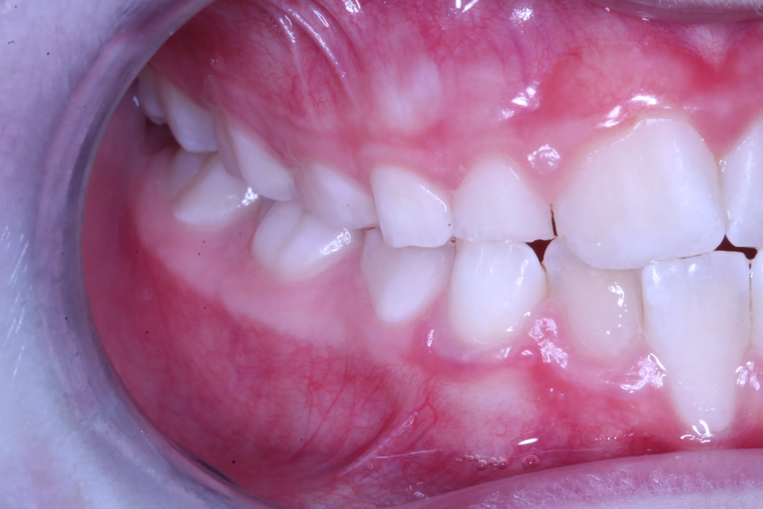 smile-gallery gallery